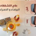 صورة مصغرة للمنتج 2