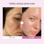 صورة مصغرة للمنتج 2